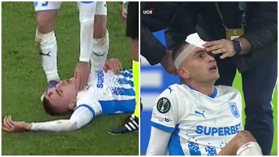 Imagini horror în Rakow - Craiova! Fundașul oltenilor a căzut la pământ, plin de sânge Imagini horror în Rakow - Craiova! Fundașul oltenilor a căzut la pământ, plin de sânge