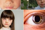Privirea copilului tău îți poate spune mai multe decât crezi: ce boli grave poți depista din ochi