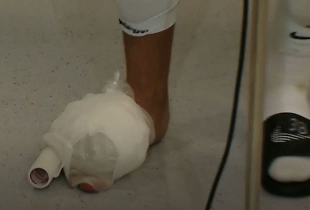 Imagini horror cu piciorul lui Mihai Lixandru. Cum a venit fotbalistul la flash-interviu