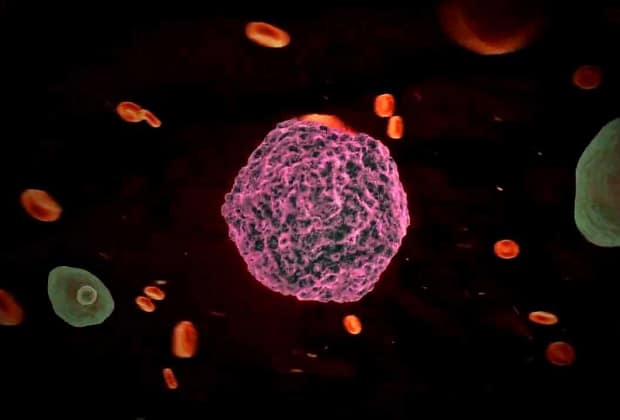 Revine febra tifoidă? O tulpină rezistentă a ceea ce se credea a fi ‘boala vremurilor de demult’ se răspândește din nou pe glob. Cercetătorii au lansat deja avertismente