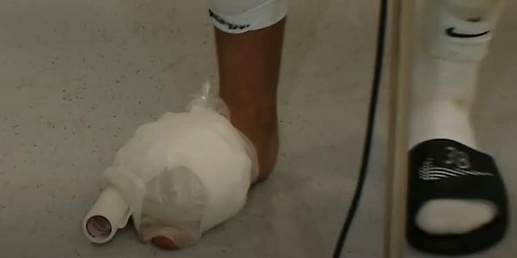 Imagini horror cu piciorul lui Mihai Lixandru. Cum a venit fotbalistul la flash-interviu